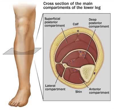 posterior thigh compartment syndrome